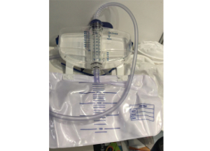 2000ml Urine Bag with 500ml Meter